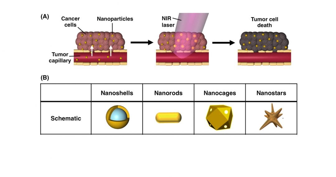 Gold Nanoparticle-Mediated Photothermal Therapy: Applications and Opportunities for Multimodal Cancer Treatment