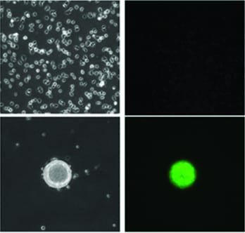 A High-Throughput Cell Chemotaxis and Migration Inhibitor Screen