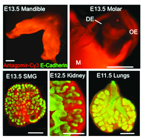 Functional microRNA Screen for Organ Morphogenesis