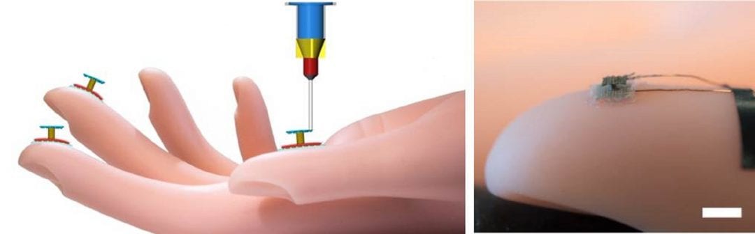 3D Printing a Tactile Sensor on a Fingertip