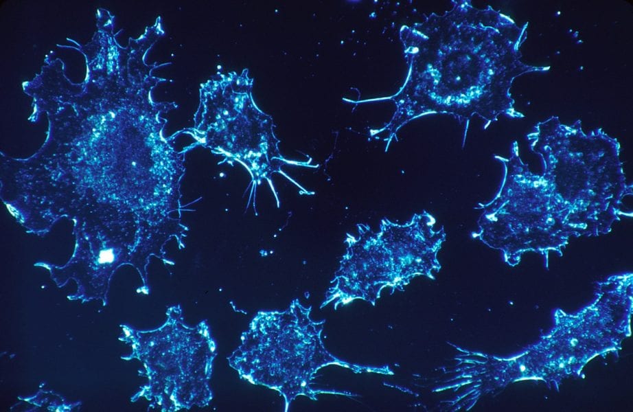 Cancer Metastasis Hobgoblins: Circulating Tumor Cell Clusters