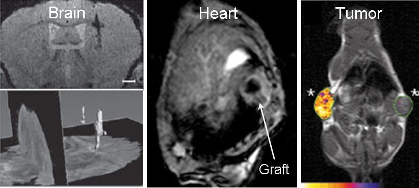 Genetically-Encoded Iron-Associated Proteins as MRI Reporter