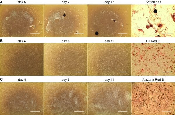 Umbilical Cord Mesenchymal Stromal Cell Isolation and Characterization