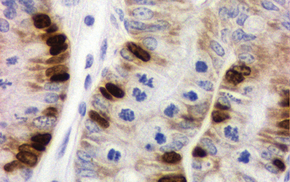 Quantification of Epithelial Cell Proliferation, Cell Dynamics and Cell Kinetics In Vivo