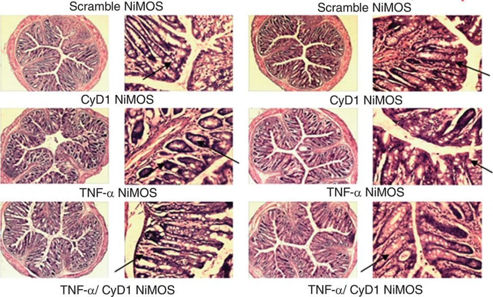 Oral Nucleic Acid Therapy for Gastro-Intestinal Diseases