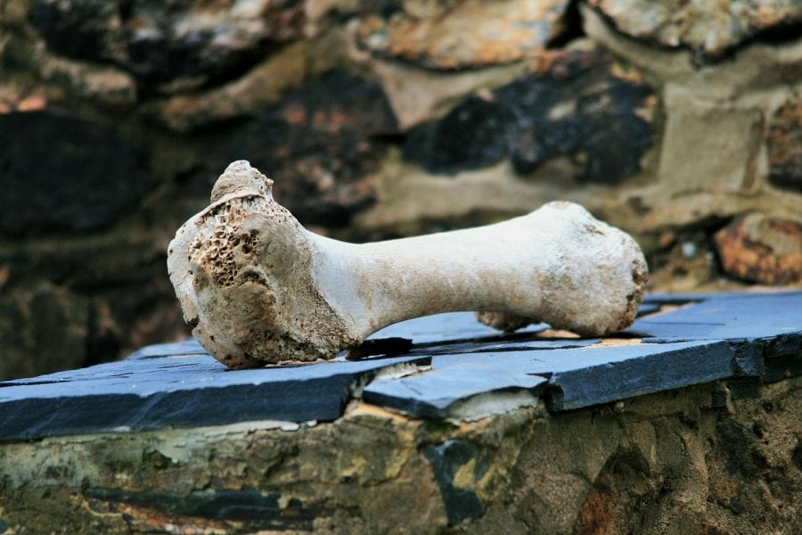 Bone-Inspired Metallic Tubes