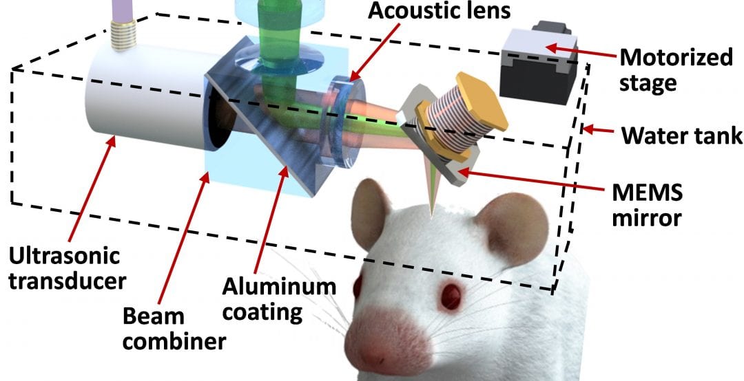 Small But High-Speed Steps Closer To Understanding Brain Strokes