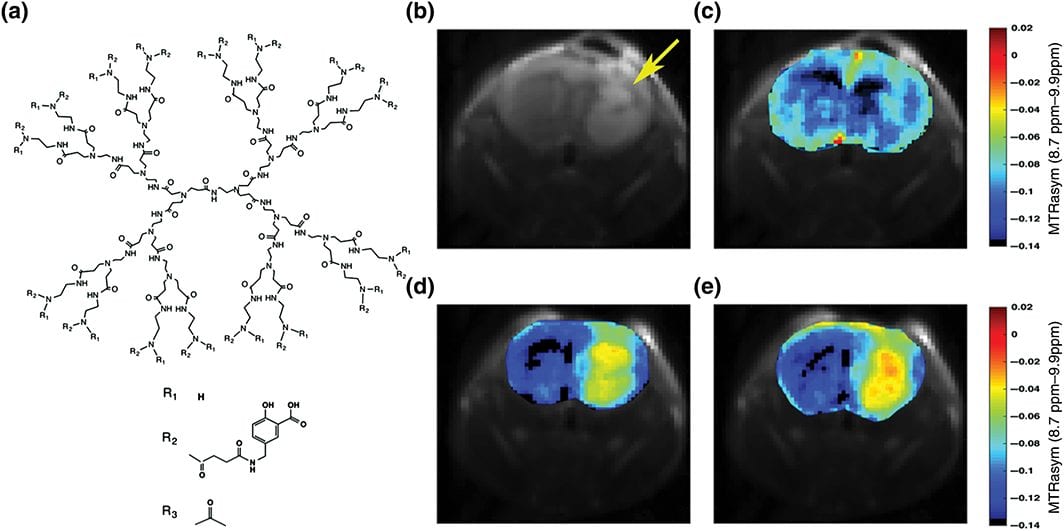 Two Decades of Dendrimers as Versatile MRI Agents: A Tale with and without Metals