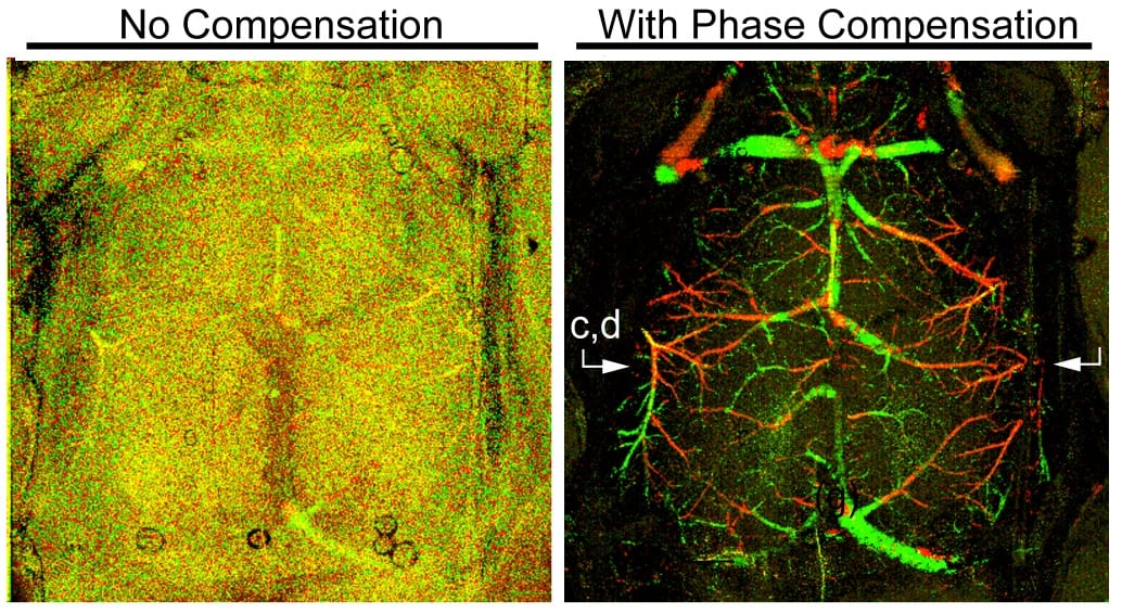 Stabilizing Optical Coherence Tomography