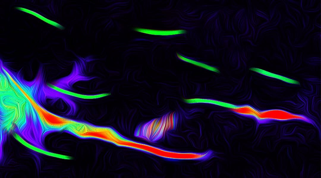 Fiber Directed Cell Growth in Injectable Hydrogels