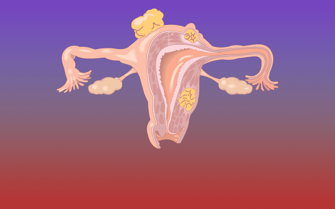 Ancient and Modern Hints: Chemotherapy Resistance in Ovarian Cancer