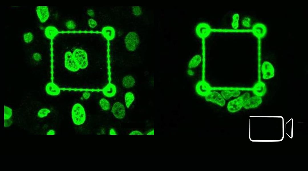 Cancer Invasion Rate Modulated by Microenvironment Stiffness