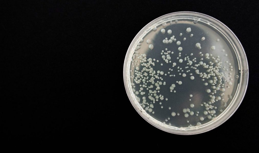 Chloride and Plasma: An Antibacterial Match?