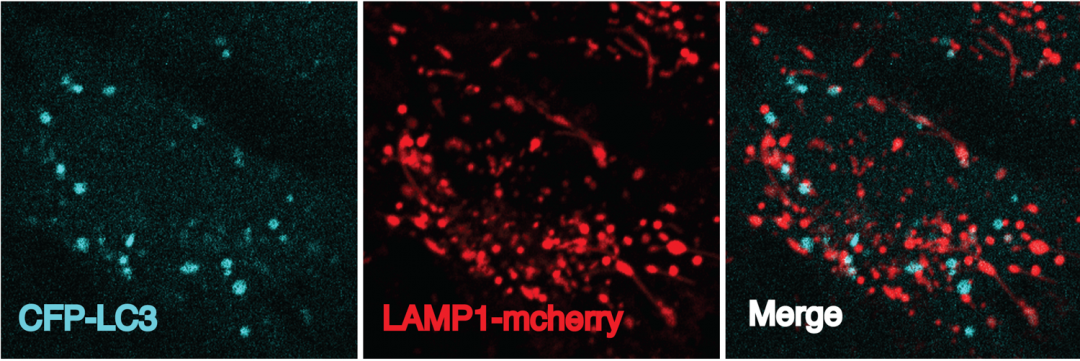 Studying Autophagic Lysosome Reformation