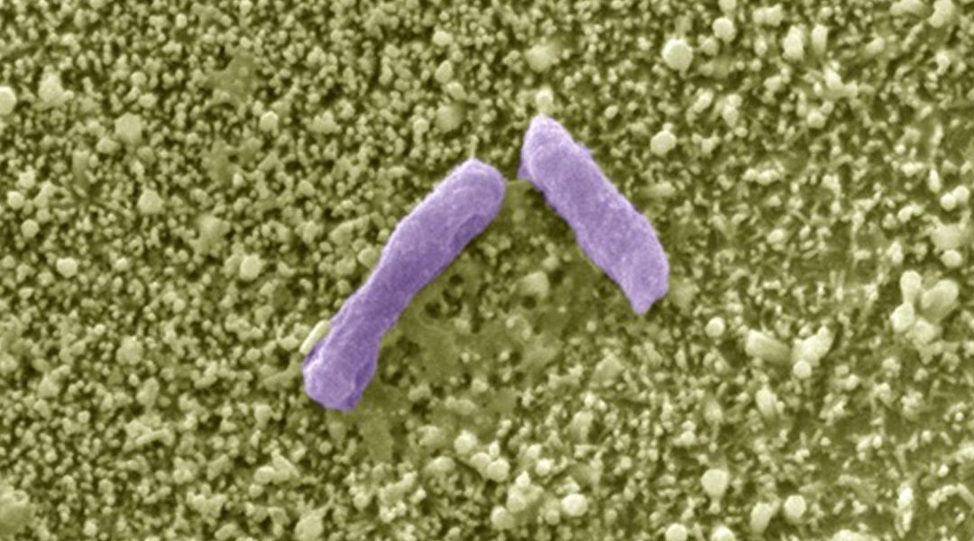 Microbial Sensors Based on ZnO Nanorod Arrays [Video]
