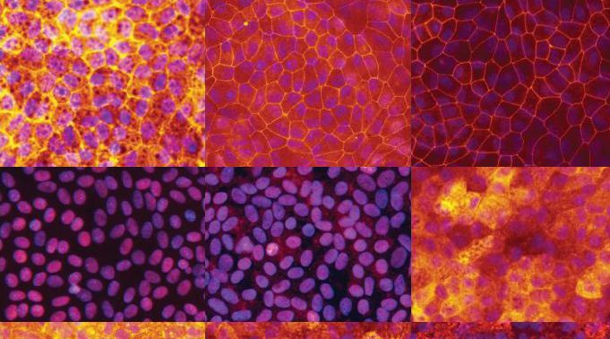 Advanced Protocol for Modeling Retinal Pigment Epithelium-related Diseases