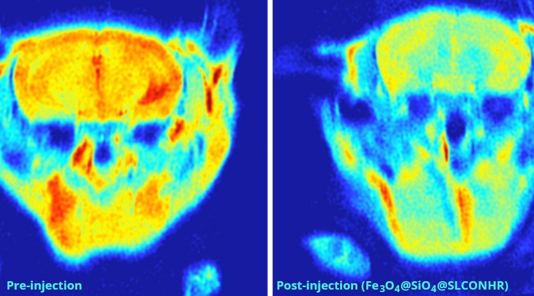 A Dual-Modal Probe for Early Detection of Alzheimer’s Disease [Video]