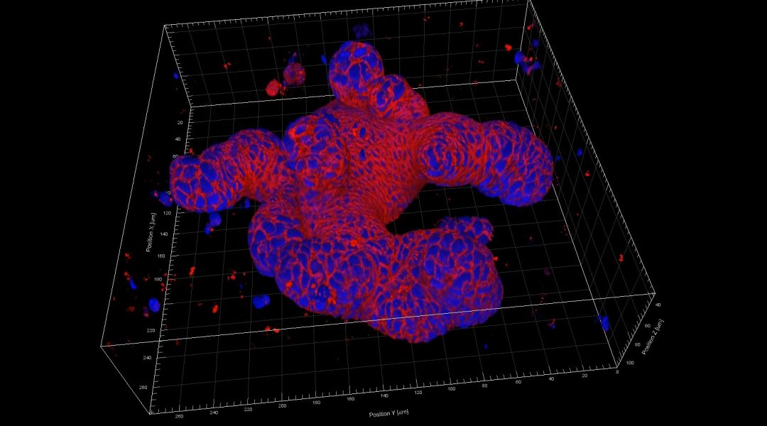 A Fibrin-Based Scaffold for Organoids [Video]