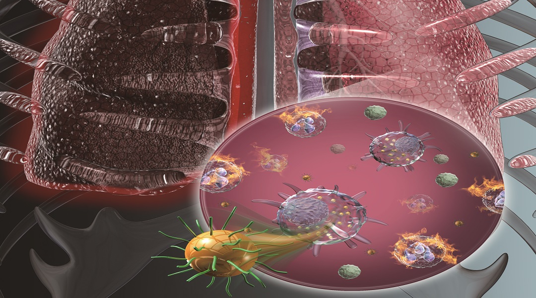 Cover Art: Osteogenesis, Anti‐Inflammatory Nanotherapeutics & Bone Regeneration