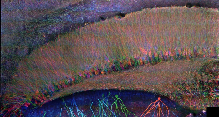 Expansion Microscopy Enabling Nanoscale-Resolution Imaging of Preserved Cells and Tissues