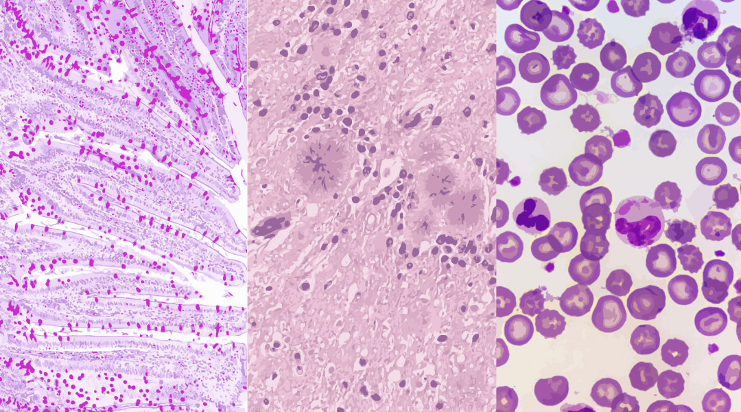 Systems Biology of Robustness and Homeostatic Mechanisms