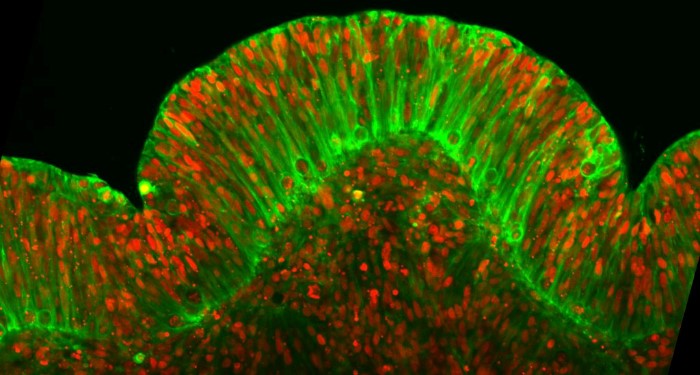 Live-Imaging of Human Brain Organoids