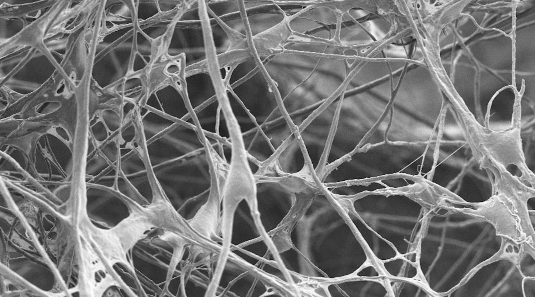 Mimicking Brain Connectivity with a Graphene–Carbon Nanotube Web [Video]