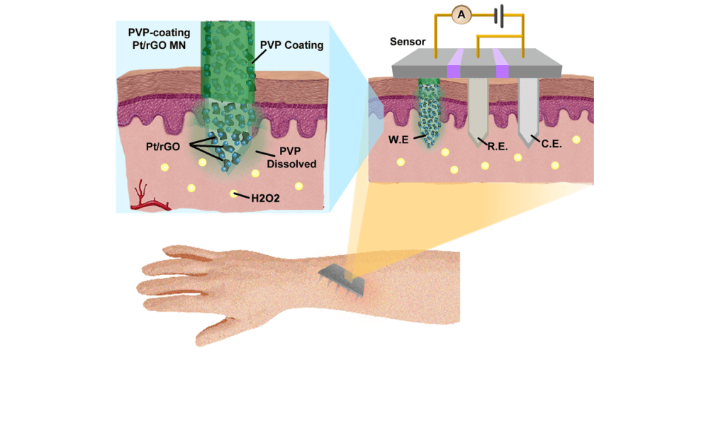 MinimallyInvasive Electrodes for RealTime Transdermal Biosensing