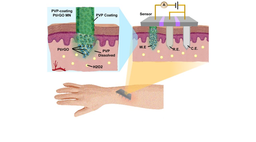 Minimally-Invasive Electrodes for Real-Time Transdermal Biosensing