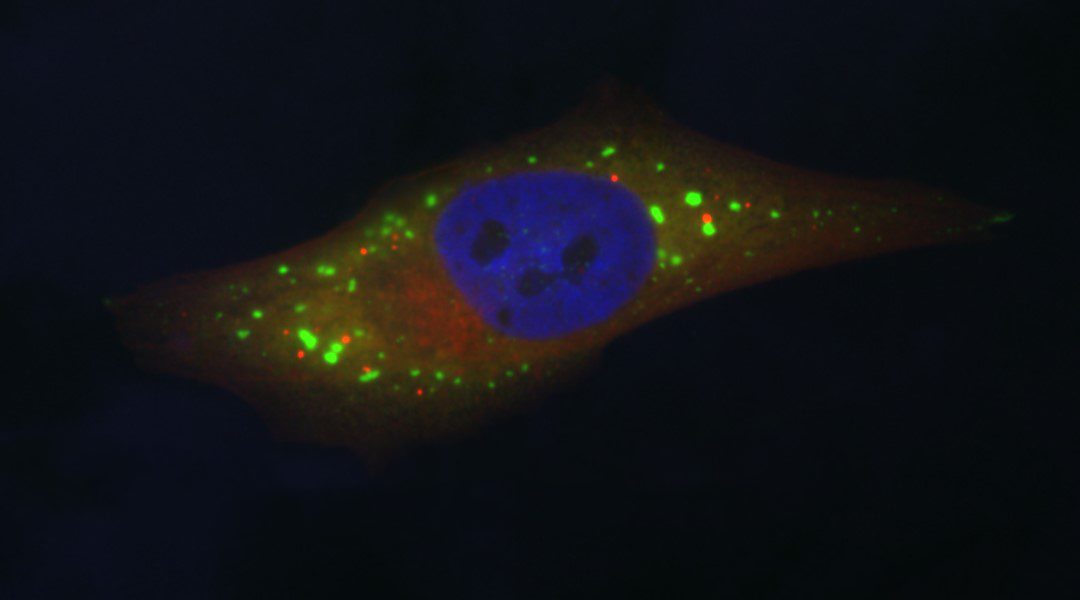 Stress-Induced mRNP Granules: Form and Function of P-bodies and Stress Granules