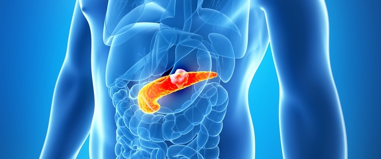 Plasma and Pills Together Combat Pancreatic Tumors