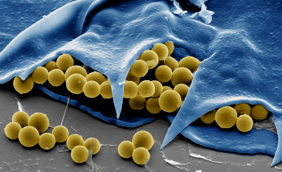 Rotibot: A Biohybrid Microrobot for Water Decontamination