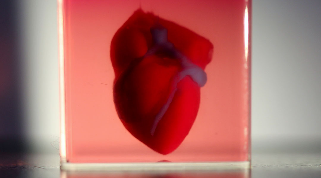 3D Printed Heart with Patient’s Own Cells