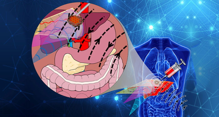 Trackable Smart Drug Delivery System for Cancer Treatment