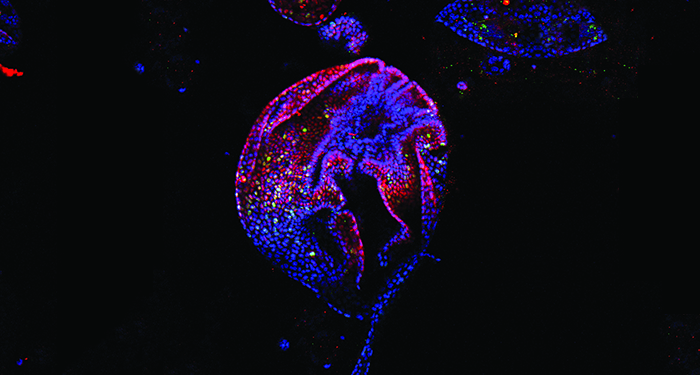 Generation of Pancreatic Ductal Organoids