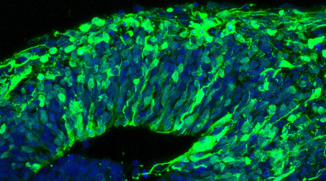 Brain Organoids to Study the Developing Human Brain