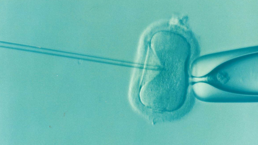 Assessing the Fertility of Sperm