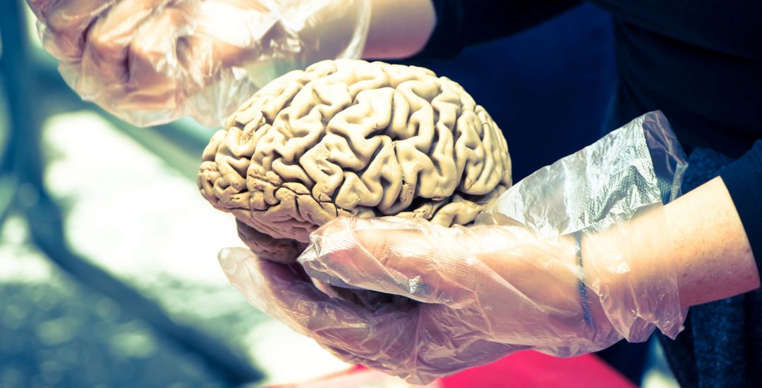 Delivering Stroke Therapeutics to the Brain