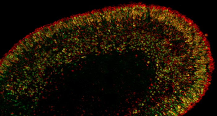 Automated Large-Scale Production of Retinal Organoids