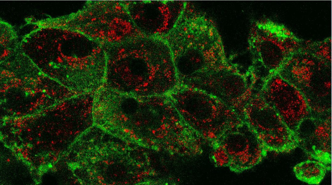 Can Nanoparticles Boost Anticancer Photodynamic Therapy?