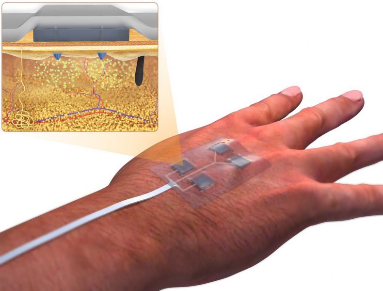 Smart bandage to heal chronic wounds