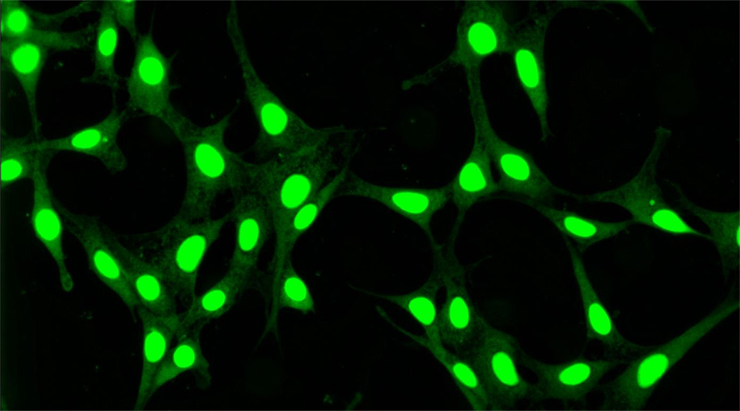 Improving how we image cells using carbon dots