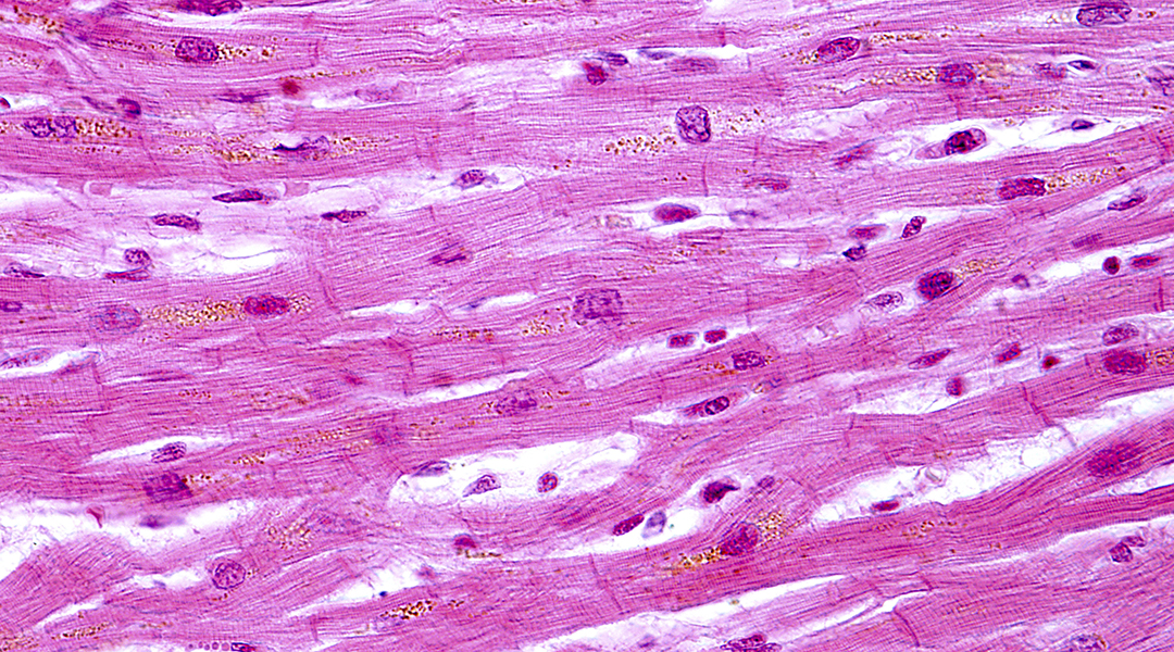 Mending a broken heart with bioengineering