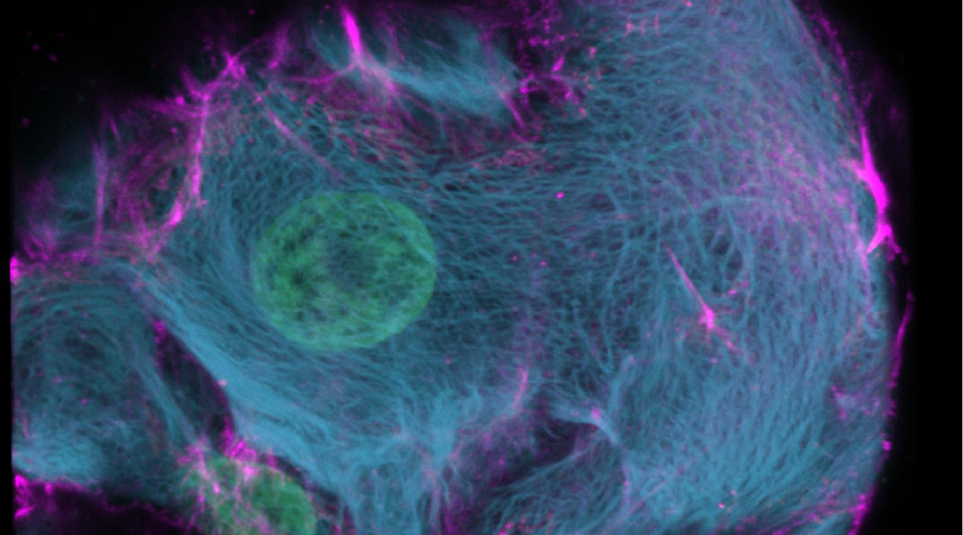 CRISPR-HOT: A new tool to visualize cells