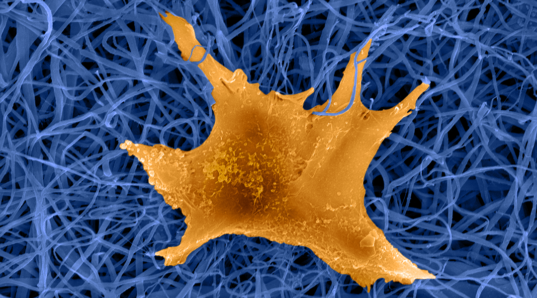 How can bioinspired nanofibers regenerate skin and aid wound healing?