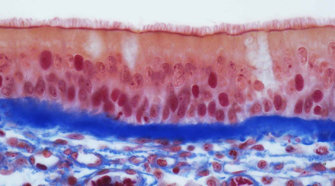 What cells does SARS-CoV-2 attack?