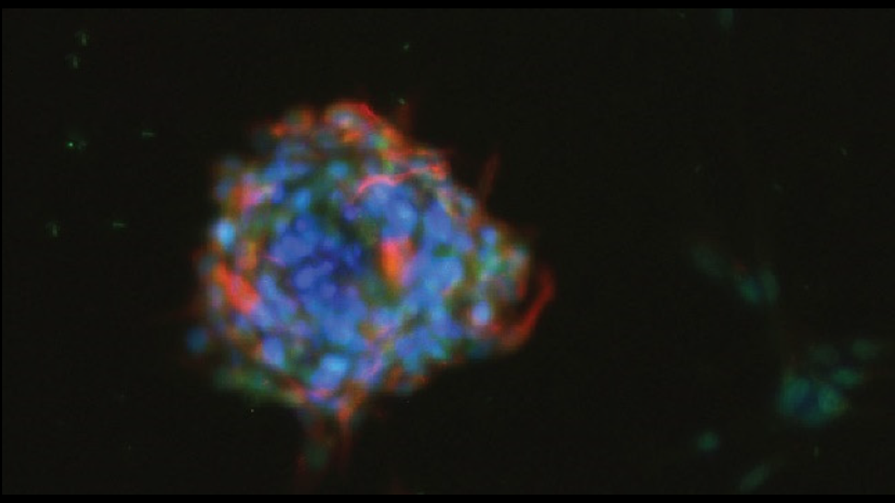 Speeding up neuron growth with a phage