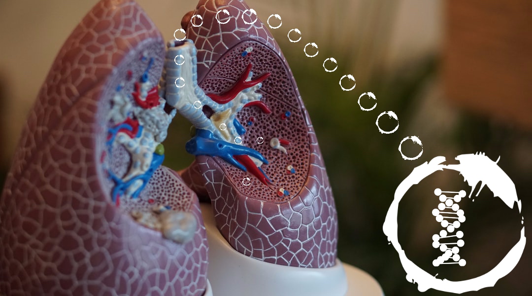 A new, inhaled siRNA therapeutic option for asthma