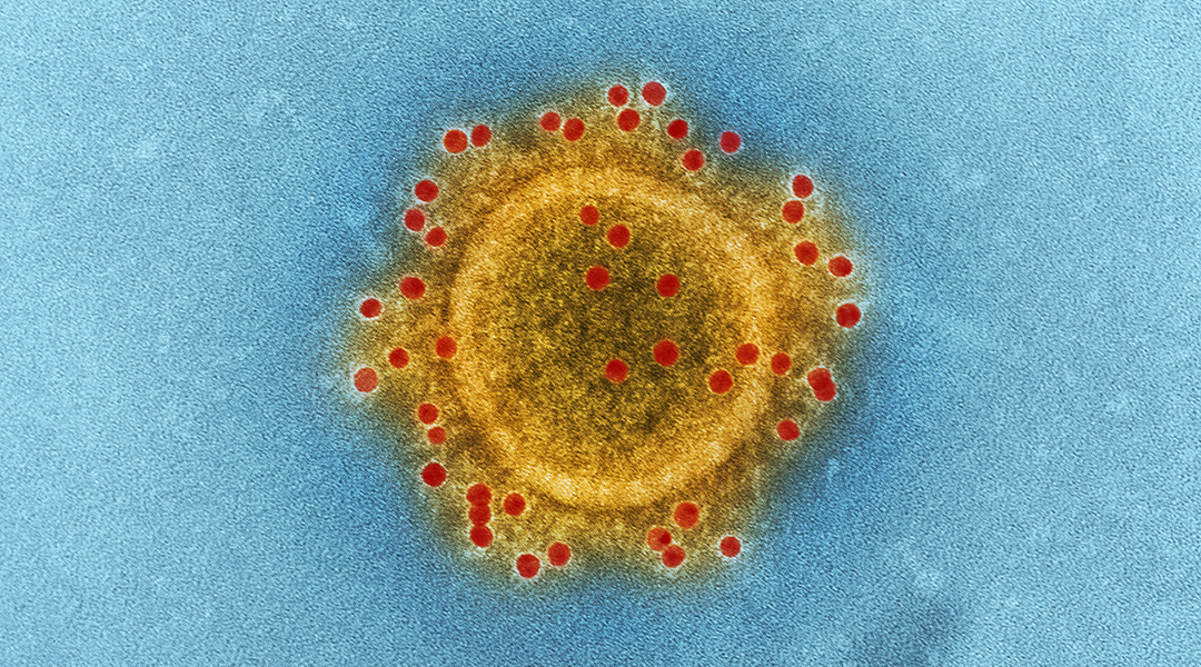 Virus-scanning tool could detect previous COVID-19 infections and aid in vaccine development