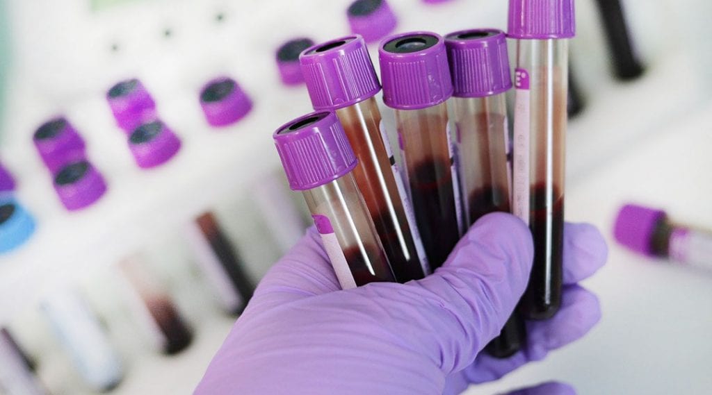 Step-by-step guide on how to make new antibody test published ...